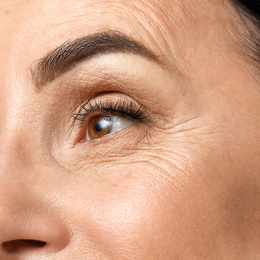 SKIN AGING