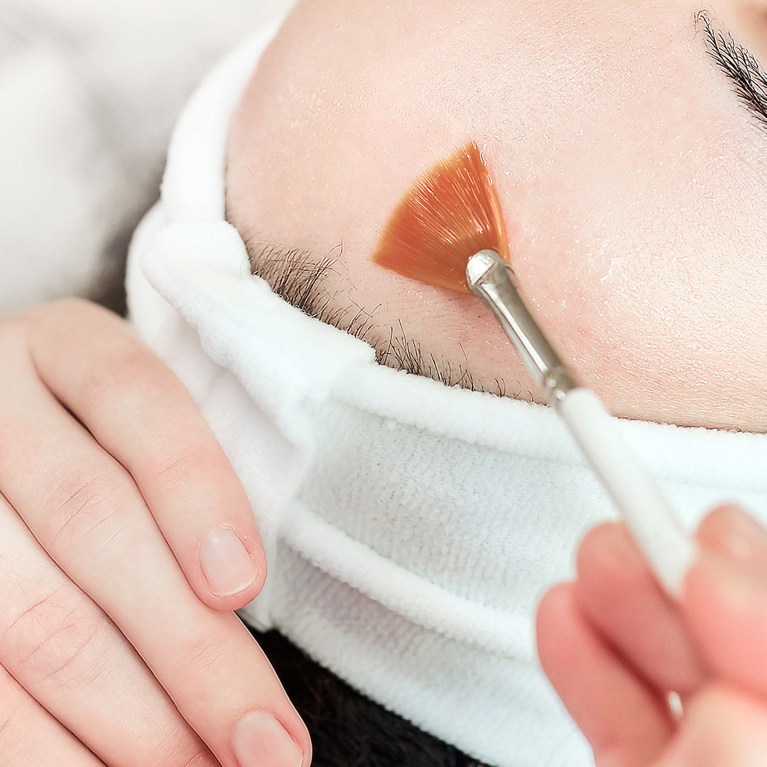 Provider's Secrets: How to Keep Patients Satisfied and Loyal to Your Microneedling Services