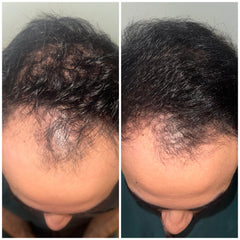 Load image into Gallery viewer, Image