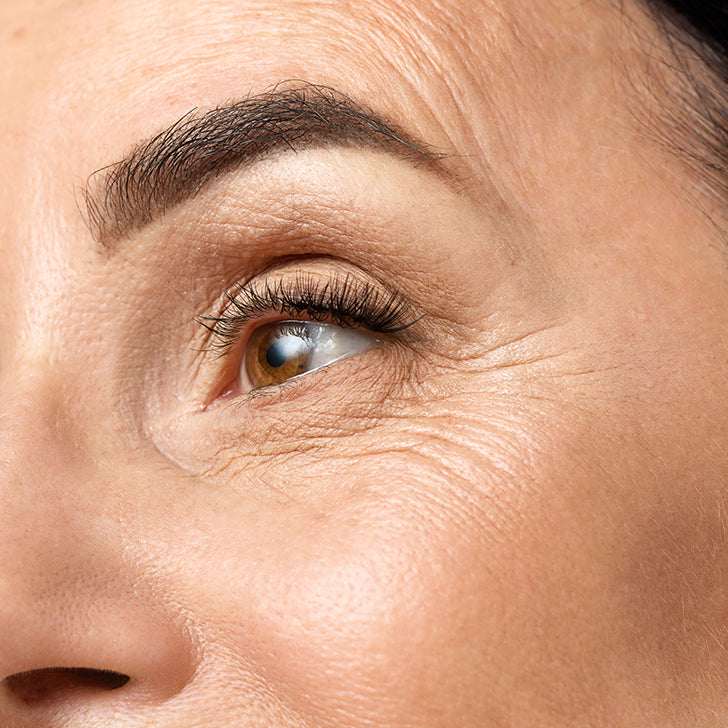 Fine lines & wrinkles