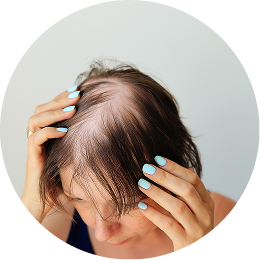 SCALP IMBALANCE