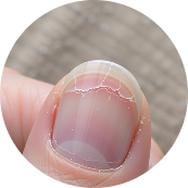 NAIL SUPPORT