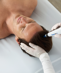 GO BEYOND WITH MICRONEEDLING