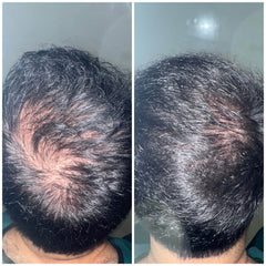 Load image into Gallery viewer, Image