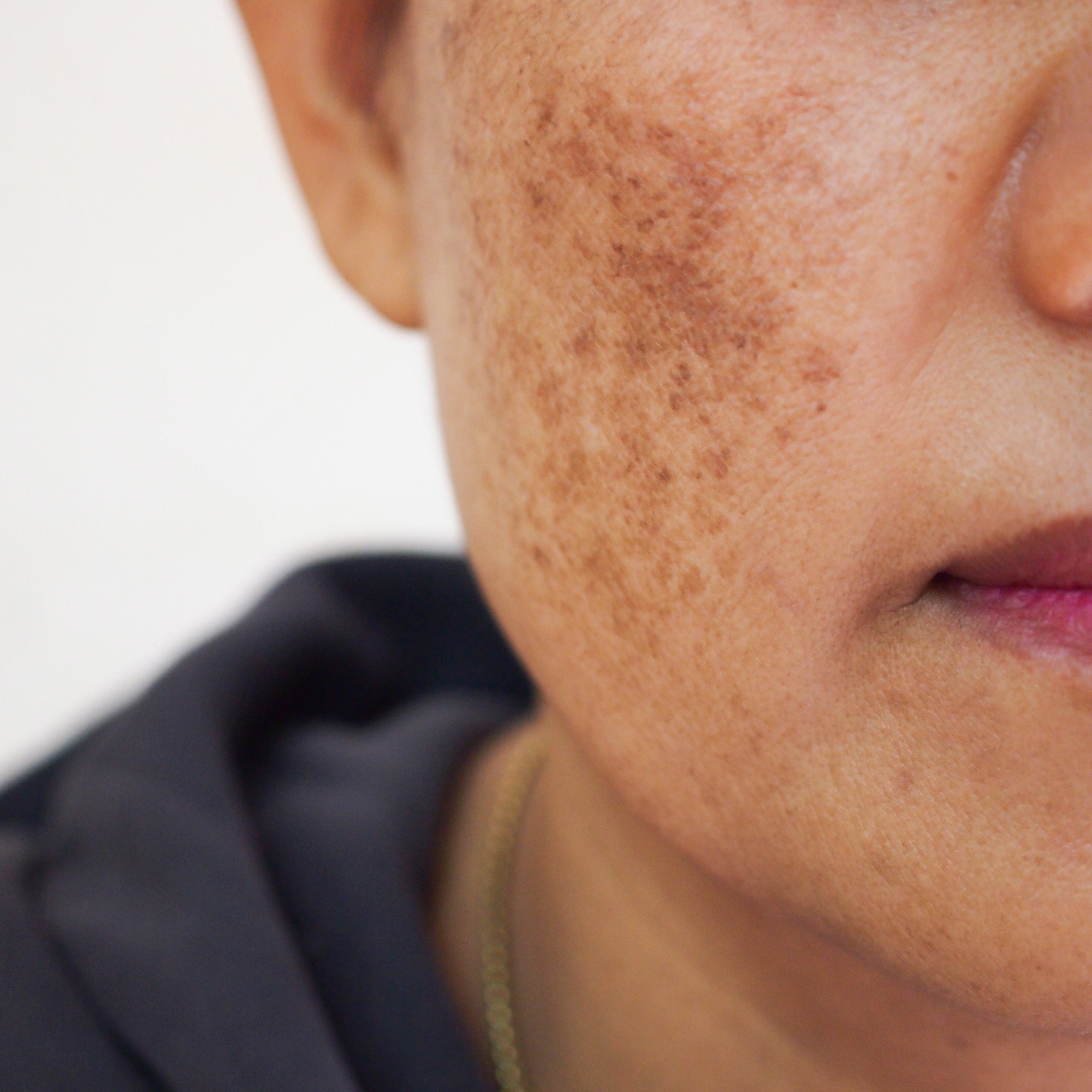IMPROVE THE APPEARANCE OF DARK SPOTS
