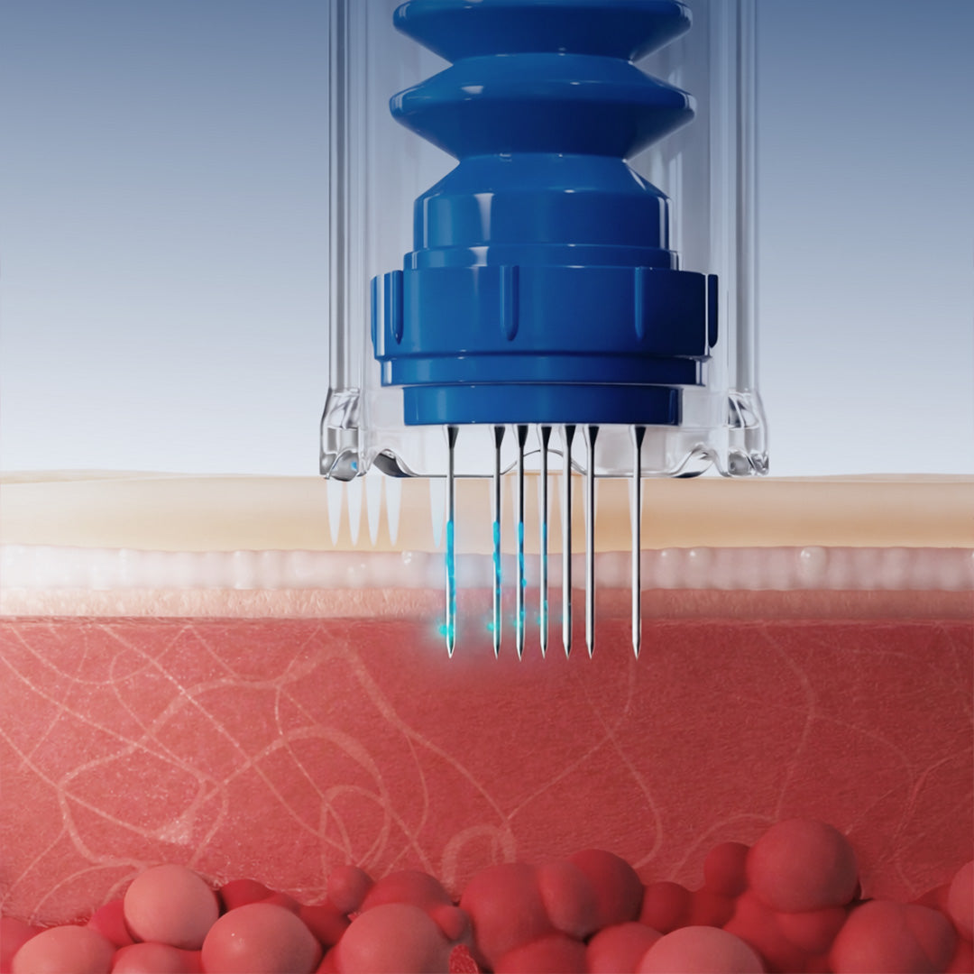 2010 — FIRST MICRONEEDLING DERMAPEN CREATED BY DERMAPENWORLD