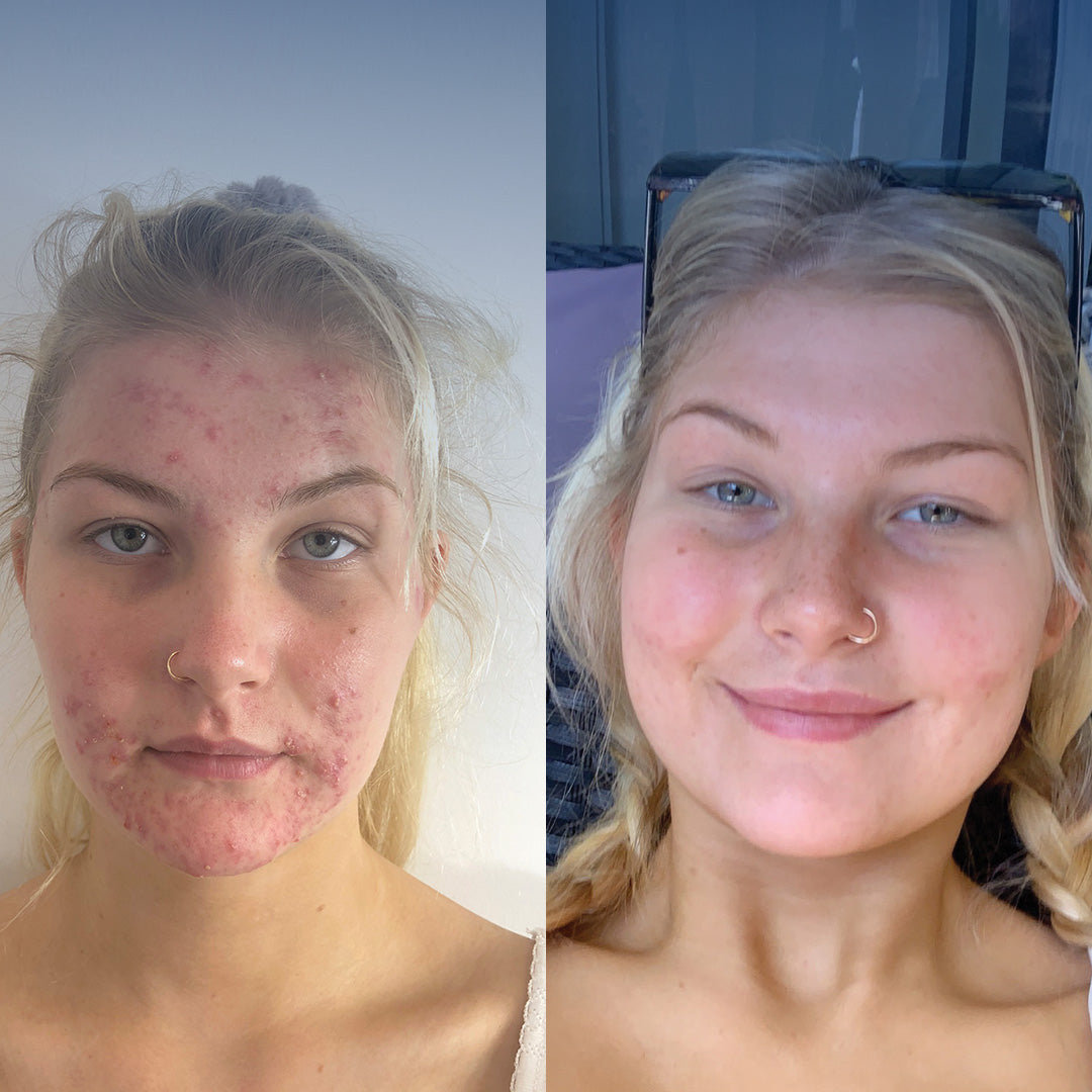 Targets Multiple Skin Concerns
