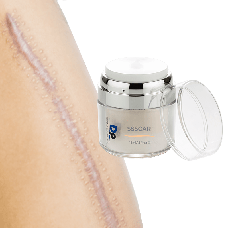 SSSCAR (15ml) 3